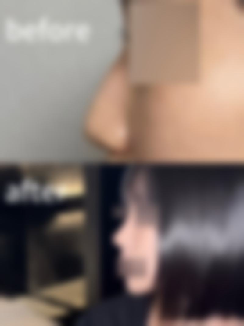三、徐英杰擅长项目及优势: