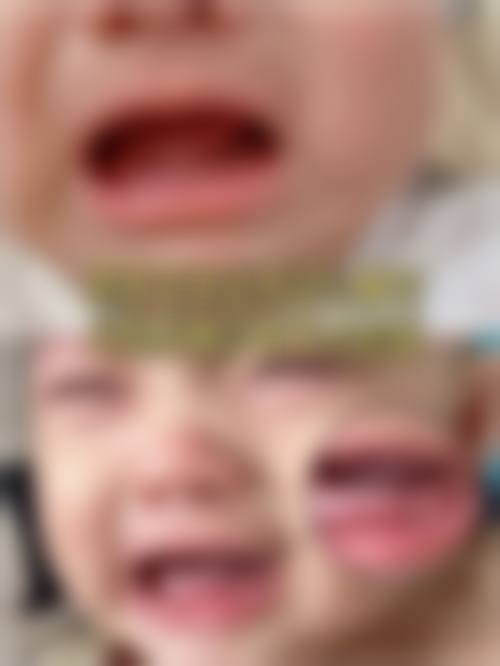 优惠活动详情:限时价格助力口腔健康