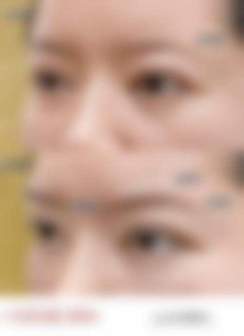 十四、天津艺馨国内外医疗美容患者常见问答