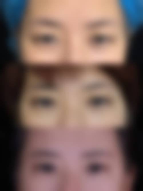 优惠详情与到院指引