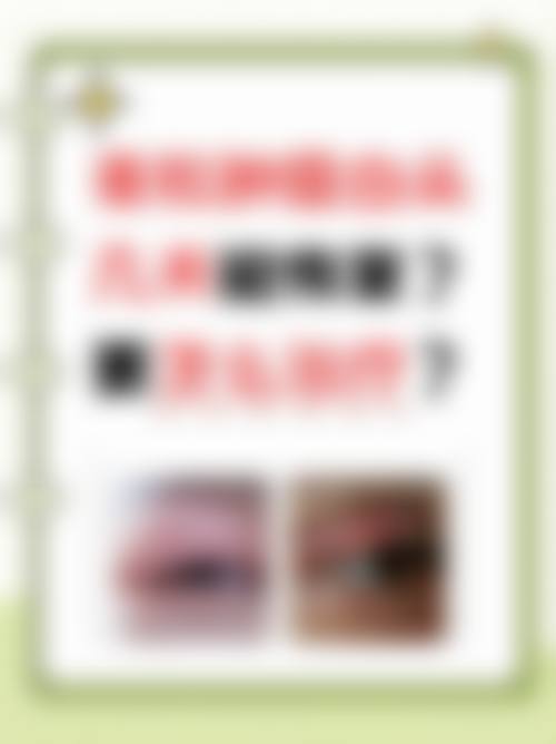 预约优惠活动