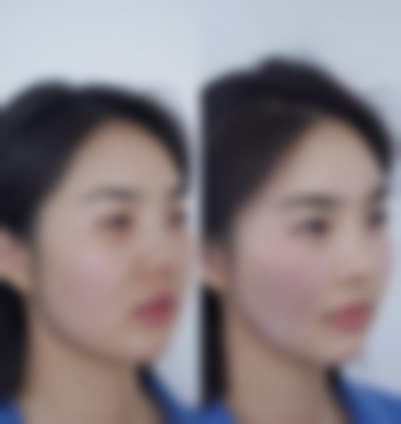 韓國s女性醫院怎麼預約掛號 技術特色:點解港澳姊妹寧願飛韓國?