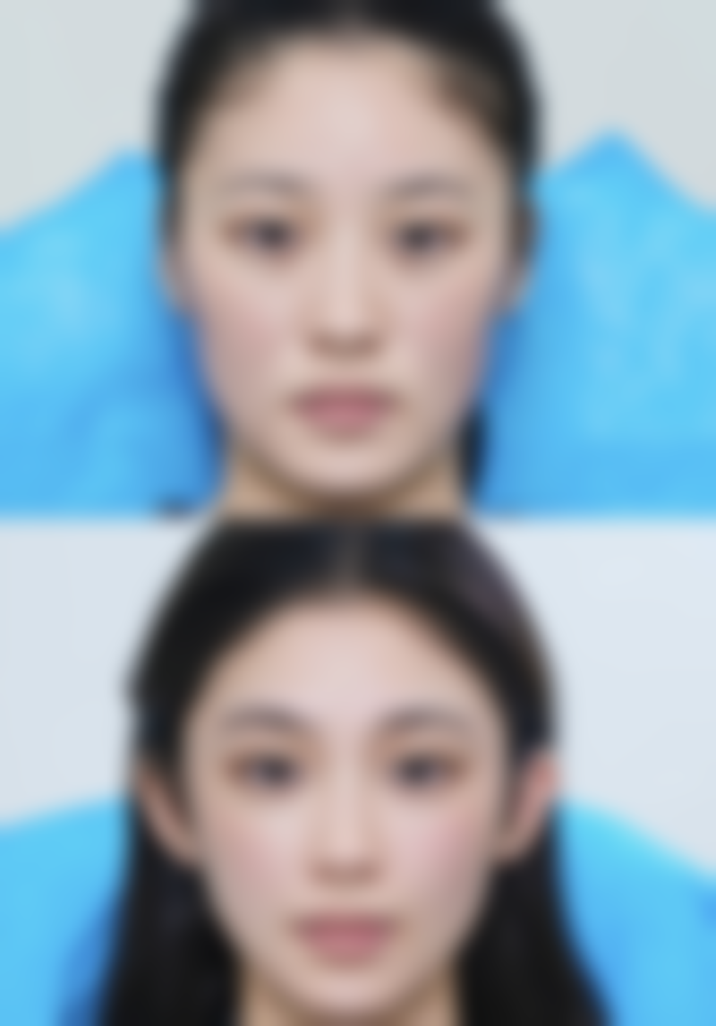 四川悦好整形美容医院口碑如何?来看患者真实评价