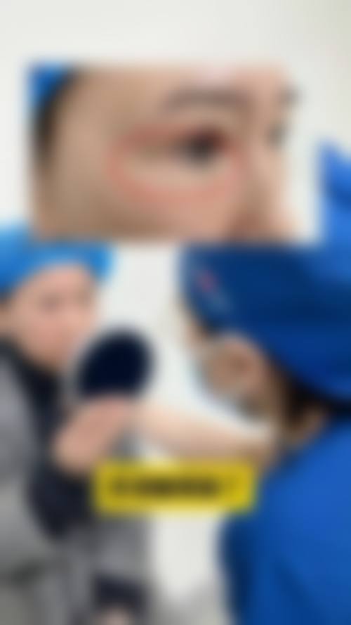 三、3个月时视觉成效稳定对修复的意义