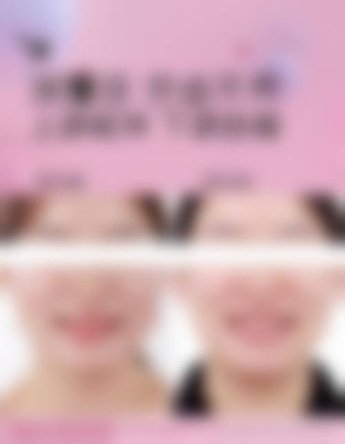优惠活动详情——透明定价,限时补贴
