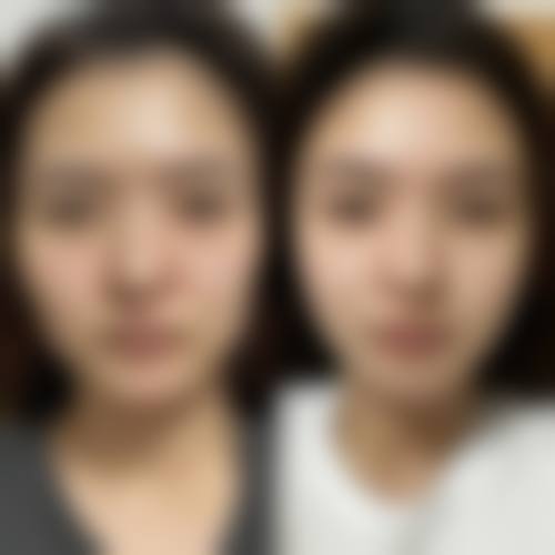 结语:越然医美,助您回归自然之美