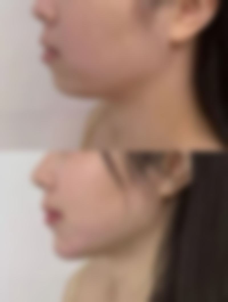 凉山会理廖氏牙科诊所温馨提示——为了节省您的时间,看诊前请预约哦!