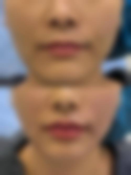 七、许丽君医生价格表(2026年参考价)