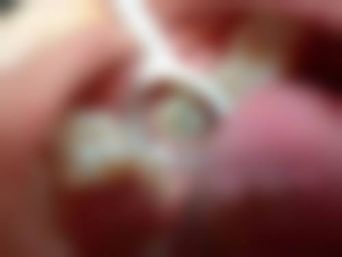 结尾：选择百灵鸟，开启健康笑容之旅