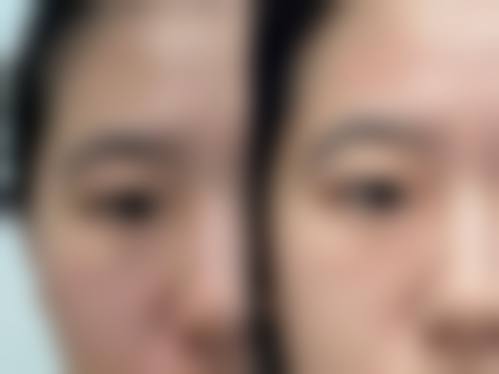 临床实例分享