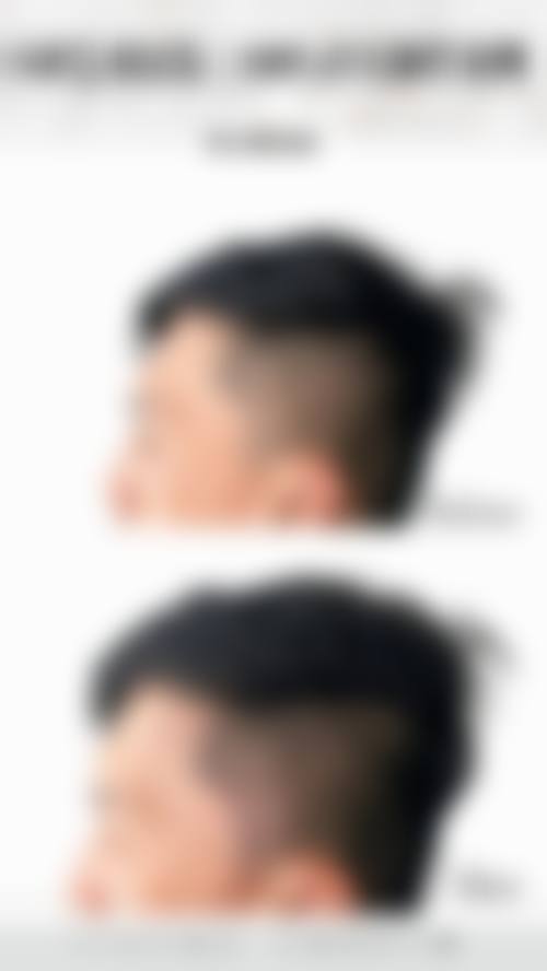 特色项目:个性化除皱与年轻化方案