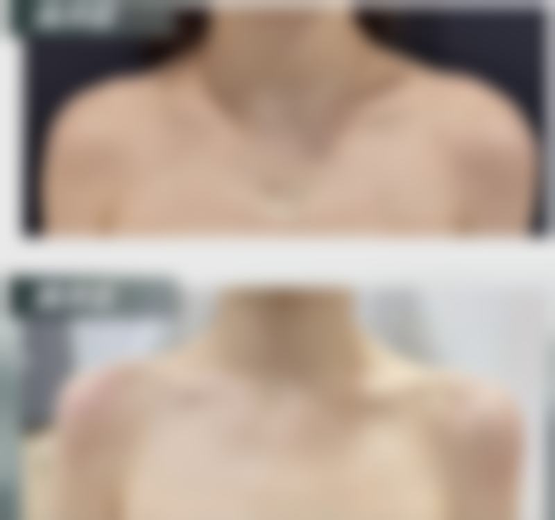 预约优惠活动