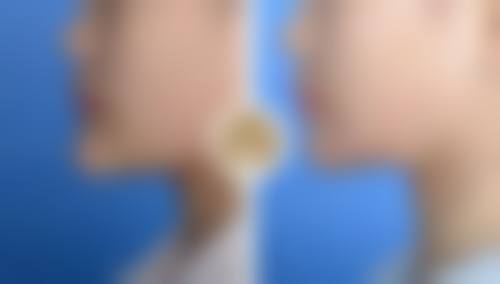 韓國整形醫院推薦dcard 價錢範圍(HKD)+ 深圳口岸對比