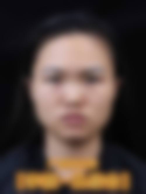 结语:选择安美,开启安心变得更美之旅