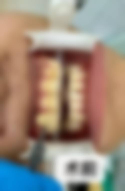 广州曙光医学美容医院牙科中 心温馨提示——为了节省您的时间，看诊前请预约哦！