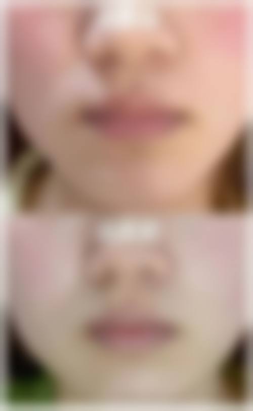 包头军大皮肤病医院价格表/收费标准一览