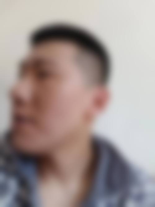 包头军大皮肤病医院患者常见问题解答（精选）