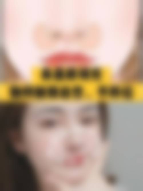 特色项目与优势:医生团队,技术不错