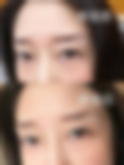 十一、济南奥维丽医疗美容诊所真人口碑实例评价一览