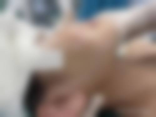 韓國輪廓手術值得做嗎:術前術後避坑指南(港澳姊妹必睇)