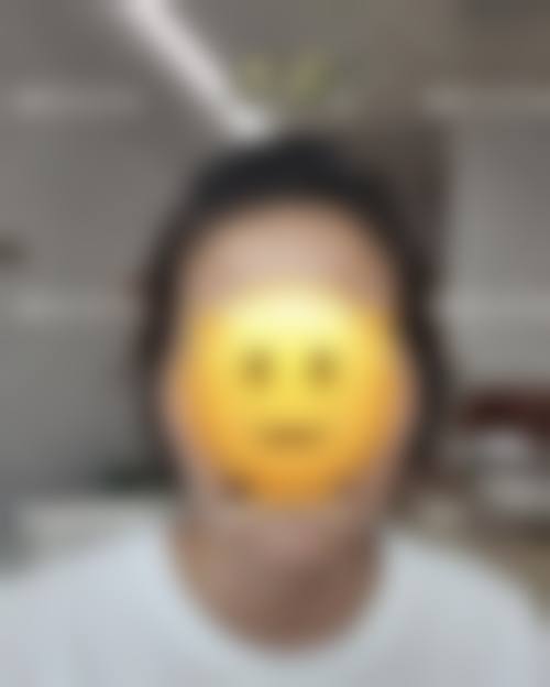 韓國輪廓手術值得做嗎:價錢對比(韓國vs港澳vs深圳/珠海)
