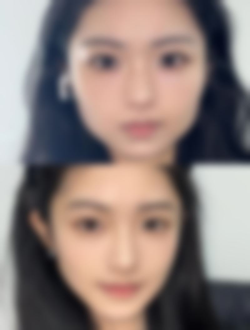 拓展延伸:香港姊妹赴韓醫美必讀指南