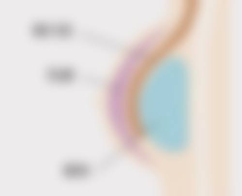 韓國男生去油縮毛孔醫美適合邊類人群?