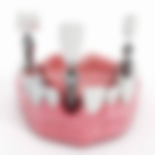 深圳種牙有冇隱藏費用？2026拆解5大收費陷阱附價錢表避坑指南