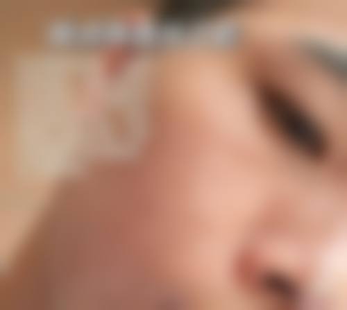 4. 第一次激光治疗全过程,比想象中轻松太多(手术过程分享)