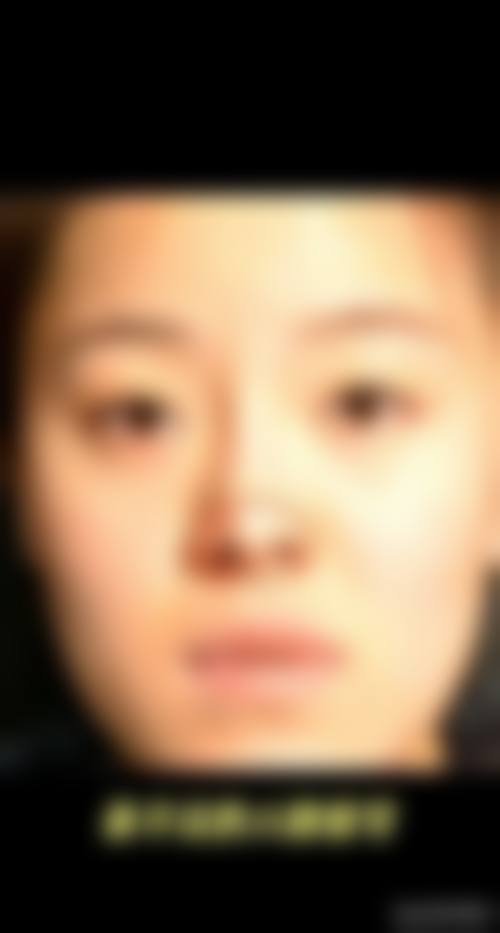 临床实例分享