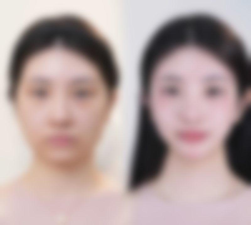 悦白3型胶原:美白与胶原再生的科学选择