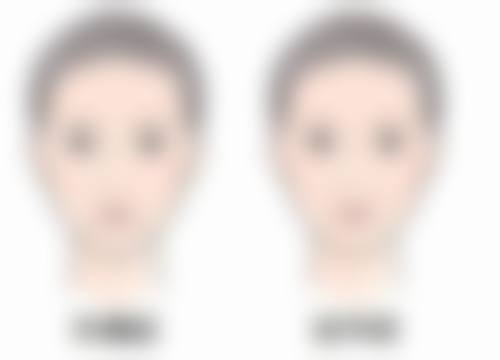 韓國醫美價格表2026:港澳幣對比