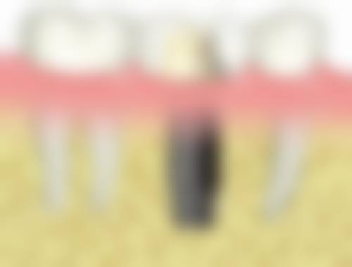 优惠活动详情:原价与优惠价透明对比