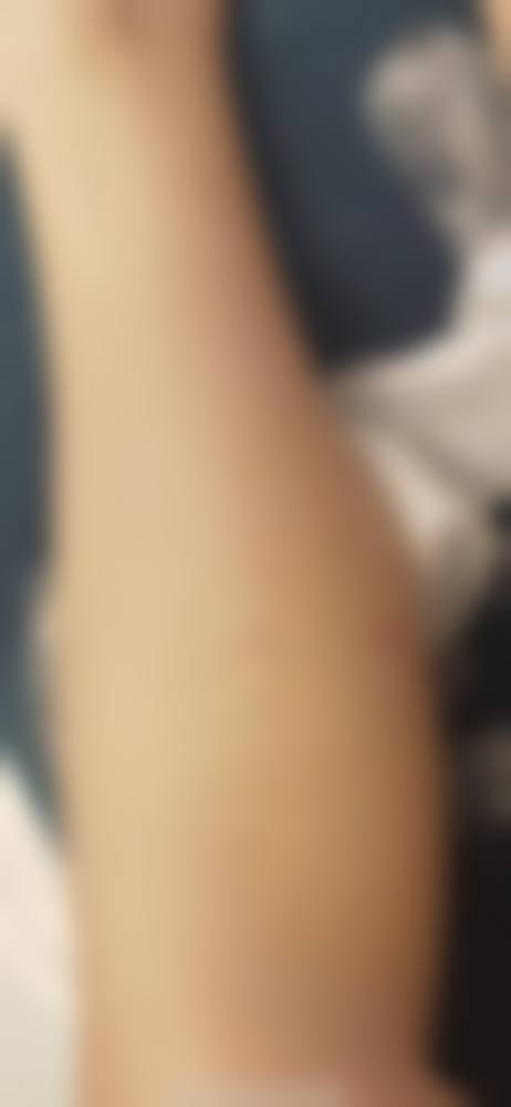 患者真实评价