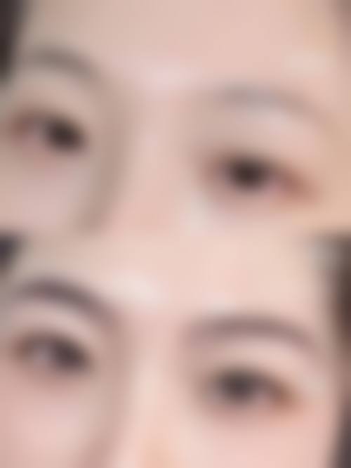 三、万惠医生擅长项目介绍