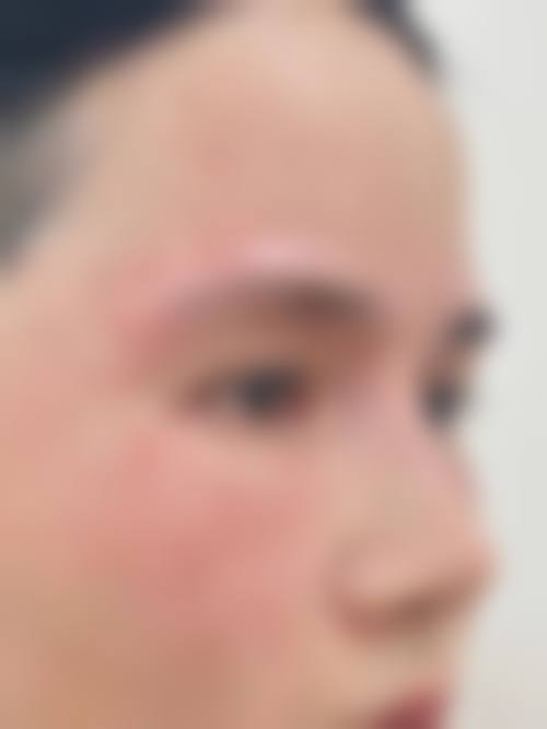 五、东莞市禾美医疗美容门诊部真实实例参考