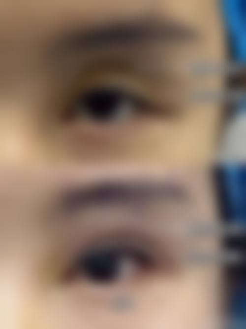 三、陈丽娜擅长项目及优势: