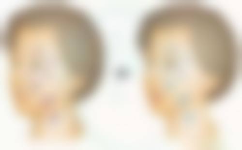 韓國dear皮膚科價格表2026中韓報價:成效維持幾耐?會唔會反彈?