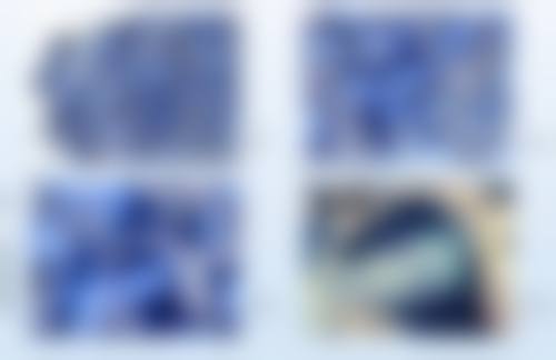 韓國View面部提升推薦 中文1v1面診實測:過程+必問問題