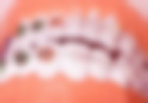深圳牙科有冇女牙醫推薦？2026排行+性價比價目表！醫生推介邊間好