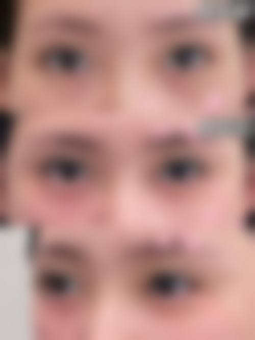 临床实例分享:祁俊医生临床实例——真实成效见证