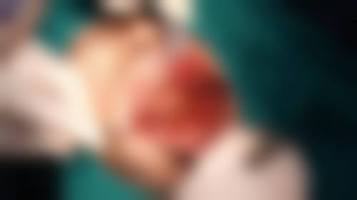 预约优惠活动