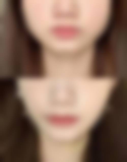 1、南昌鹏爱医疗美容医院怎么样?医院简介如下: