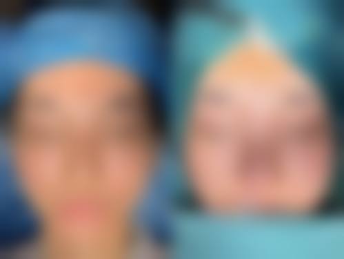 济南艾媚整形医院优惠活动