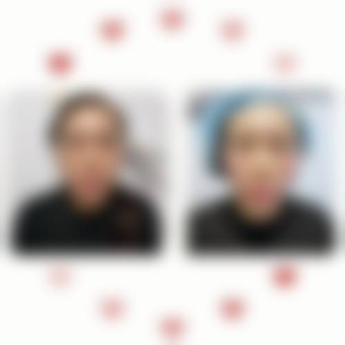 四、詹曜臣医生收费价格