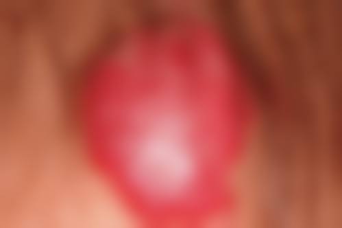 6、如皋超妍医疗美容诊所口碑好评反馈