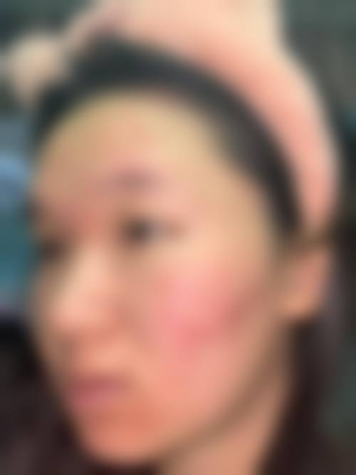 患者真实评价