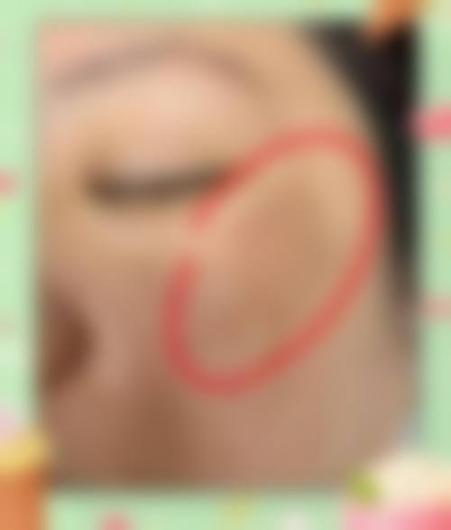 济南艾媚整形医院服务流程