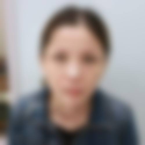 三、安多泰骨膜拉皮的适用人群与其它拉皮有何差异