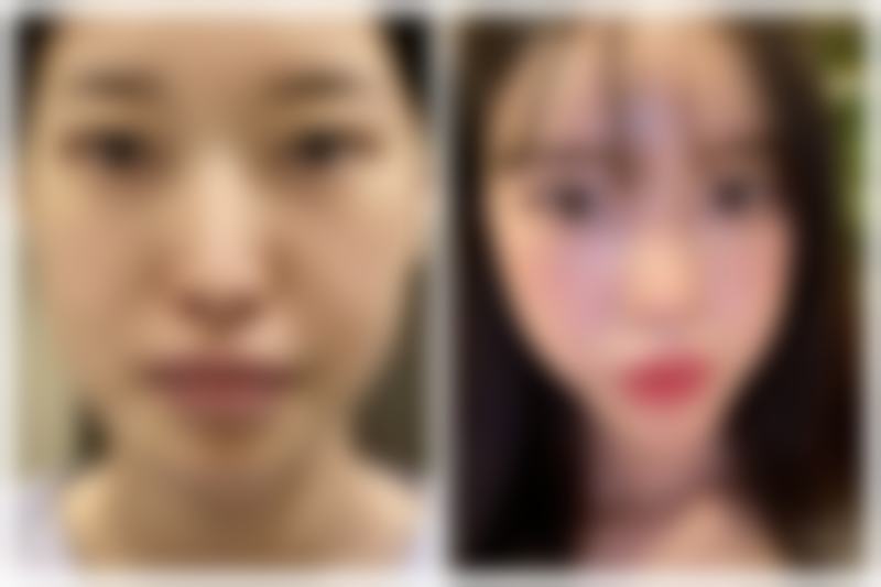 金会元医生坐诊医院——韩国Jiwoo Clinic皮肤科